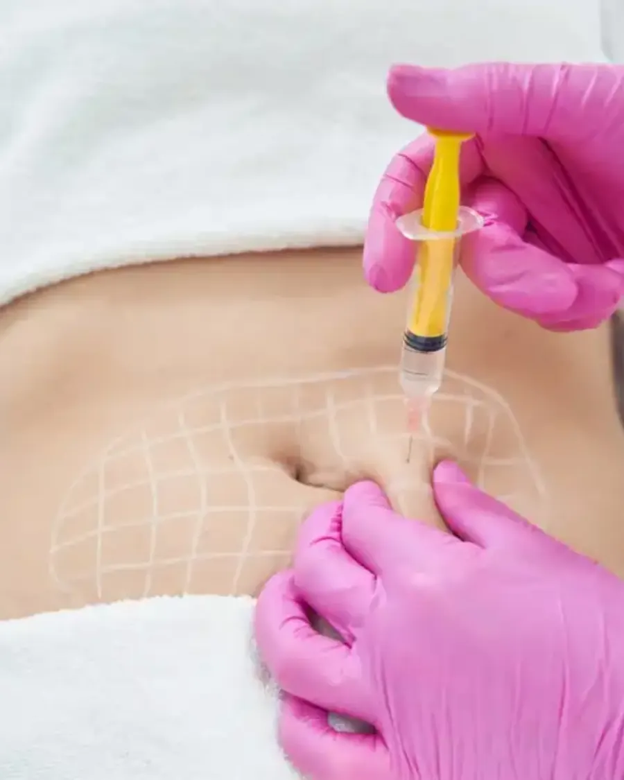 Advanced Fat Reduction with Chemical Lipolysis at Cinch Clinics